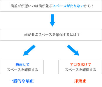 矯正方法の違いについて