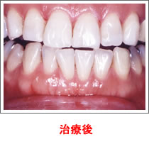 【治療後】